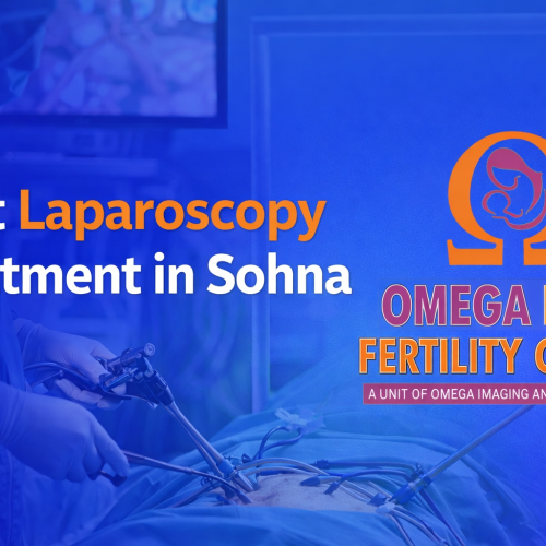 Best Laparoscopy Treatment in Sohna | OMEGA IVF & Fertility